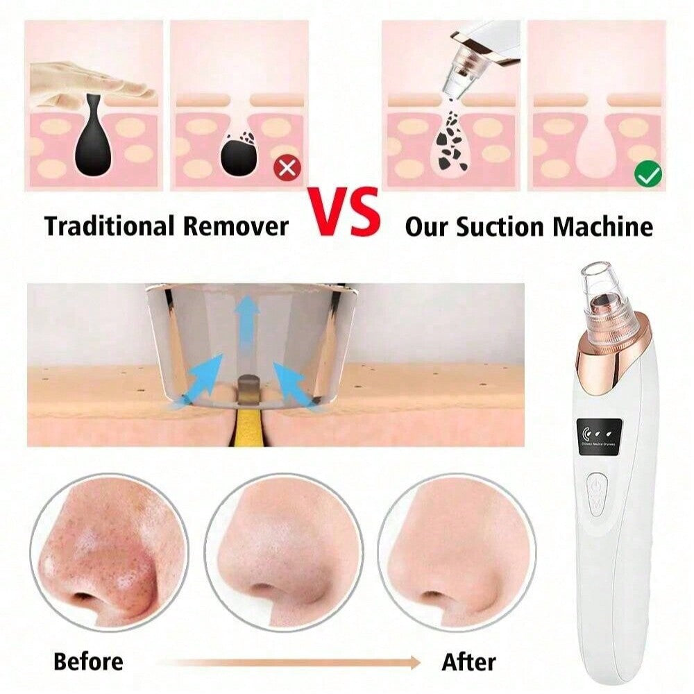 QUICKTRENDS™ – Electric Acne Pore Cleaner & Blackhead Remover